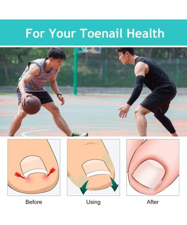 Ingrown Toenails Set Toenail Correction Toenail Toenail Patch Ingrown Toenails Tool Set Toenail Corrector Pedicure Tools Correction Sticker Toe Nails 21 Pieces - Buy Online on SooperMarket.com