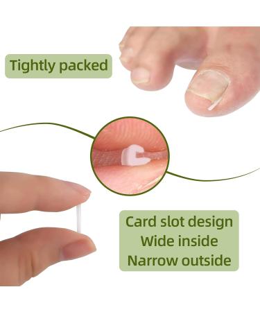(12 +3) Ingrown Toenail Correction Treatment Kit Toenail Straightener Strips Recover Clips Plastics Ingrown Toenail Correction Strips Brace Kit for Women Men Ingrown Thick Nail - Buy Online on SooperMarket.com