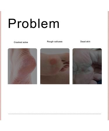 Electronic Foot File Pedicure Tool Waterproof Dead Skin Remover for Feet (Narootesacogy01tm-12) - Buy Online on SooperMarket.com
