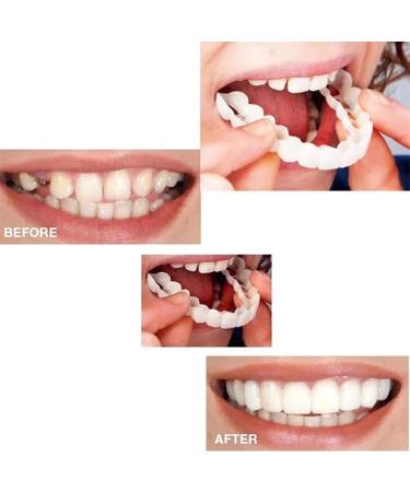 Xindinuo Snap-On Veneer Teeth - 2 Pairs | Instant Dentures for Men & Women for Confident Smile - Buy Online on SooperMarket.com