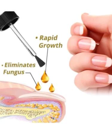 NailGro Intense Nail Growth and Strengthening Serum 7 Days Nail Growth and Strengthening Serum Natural Nail Repair Serum for Thin Nails and Growth 20ml (1Pcs) - Buy Online on SooperMarket.com