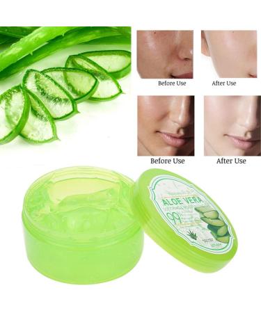 Buy Organic Aloe Vera Gel 300g - Soothing Moisture Cream for Sunburn & Dry Sensitive Skin - Ideal for Face & Body - Buy Online on SooperMarket.com
