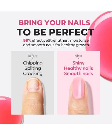 Modelones 15ml 8-in-One Nail Ridge Filler Strengthener Base Coat Nail Polish Repair Nail Growth Treatment for Thin and Damaged Nails Pink - Buy Online on SooperMarket.com