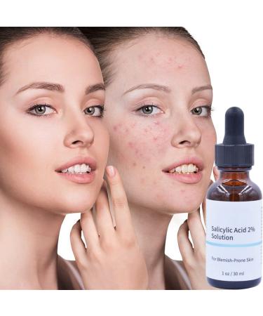Luxsea Salicylic Acid 2% Serum for Clearer Skin - Shrinks Pores, Treats Rosacea, Blackheads, and Acne - Gentle Exfoliating Hyaluronic Acid Formula - Buy Online on SooperMarket.com