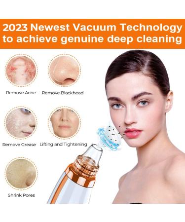 2023 Blackhead Remover Pore Vacuum - Upgraded Electric Facial Cleaner for Acne, Whiteheads - 5 Suction Power, 5 Probes - USB Rechargeable Kit for Women & Men - Buy Online on SooperMarket.com