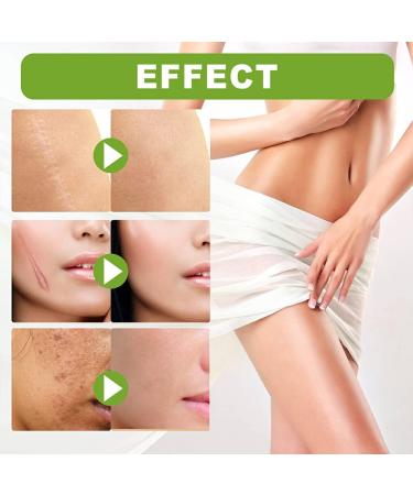 Dajidafu Women Belly Stretch Mark Body Acne Scars Removal Girls Repair Essence Anti-aging Beauty Supplies 30ml - Buy Online on SooperMarket.com