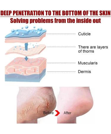 BStCar Foot Mask Socks | 5 Pairs for Men & Women | Moisturizing Foot Care Exfoliates Dead Skin & Calluses - Buy Online on SooperMarket.com