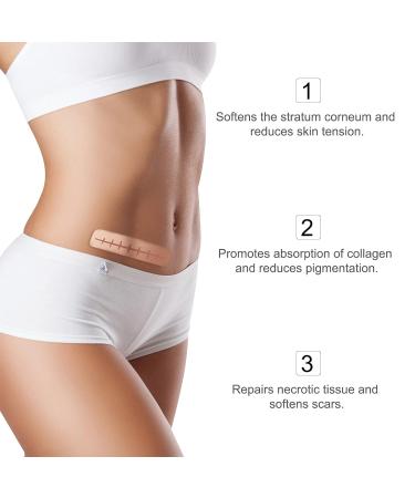 3Meters Silicone Scar Roll for C-Section Surgery Burn Keloid Acne - Drug-Free Professional Scar Sheets - Buy Online on SooperMarket.com