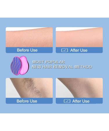 Crystal Hair Eraser Painless Hair Removal Tool Magic Nano Crystal Hair Eraser Painless Hair Remover for Men & Women Physical Epilator Apply to Any Part of Body Fast & Easy Hair Removal (Rose) - Buy Online on SooperMarket.com