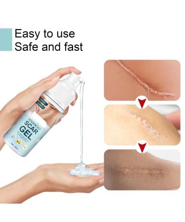 Stretch Marks & Scar Gel 50ml - Safe Vitamin E Formula for Effective Removal - Buy Online on SooperMarket.com