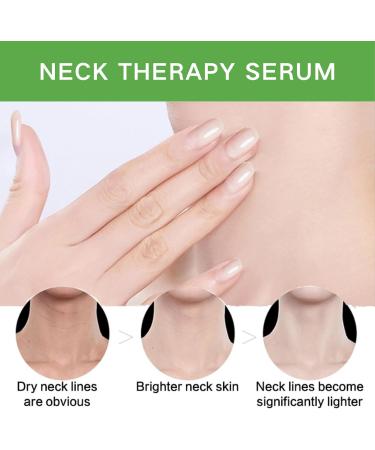 Neck Firming Cream Tighten and Lift Neck Cream Neck Line Remover Neck Tightening and Firming Vitamin C Vitamin E Moisturizing Anti Aging Reduce Neck Fine Lines Improve Roughness - Buy Online on SooperMarket.com