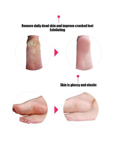 Buy Silicone Socks - Anti-Cracking Foot Protection & Moisturizing Gel Care - Soft Breathable & Comfortable (White Small) - Buy Online on SooperMarket.com