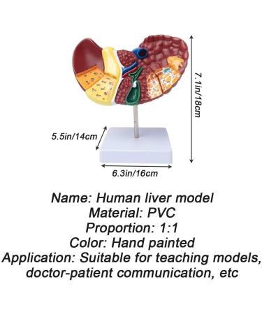 Teaching Model Human Liver Educational Model with Base and Clear Texture and Pathological Features Liver Cirrhosis Model for Medical School Study and Research - Buy Online on SooperMarket.com