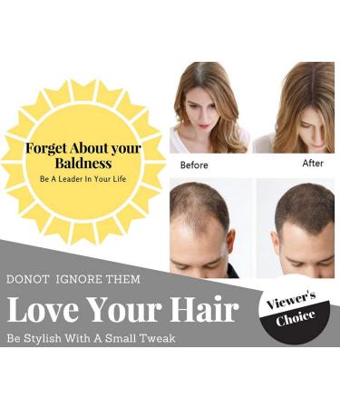 Apstour Hair Building Fibers - Instantly Conceals Hair Loss - Natural & Undetectable - 22g Black 01 - Buy Online on SooperMarket.com