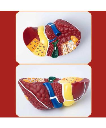 Teaching Model Human Liver Educational Model with Base and Clear Texture and Pathological Features Liver Cirrhosis Model for Medical School Study and Research - Buy Online on SooperMarket.com