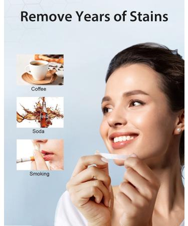 MySmile Teeth Whitening Strips - Non-Sensitive Kit, 28 Sets for 10 Shades Whiter, Removes Stains from Coffee, Wine & More - Buy Online on SooperMarket.com