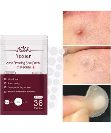 Acne Dressing Spot Patch Acne Paste Transparent Pimple Patch Breathable Painless Acne Treatment Gel Patch Skin Care Absorb Pus Rapid Healing Effective Antibacterial Protection 36 Patches - Buy Online on SooperMarket.com