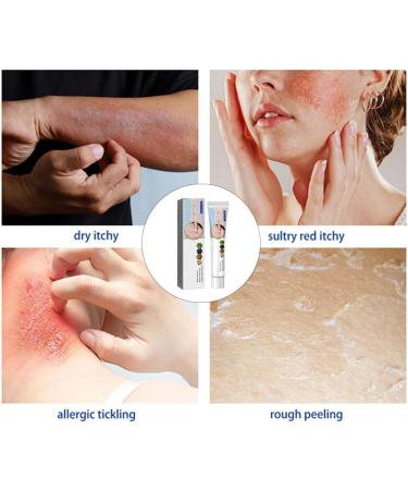 Face Cream Body Cream Anti-Itch Cream Chinese Herbal Cream Skin Repairing Cream for Face Body Cream for Itchy Skin Moisturizing Skin Cream 20 g - Buy Online on SooperMarket.com
