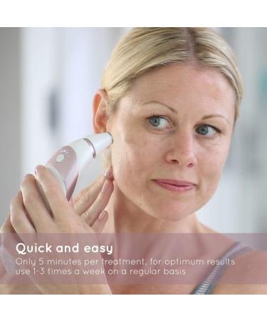 HoMedics Radiance Microdermabrasion Rose Gold - Professional Quality Salon Grade Deep Skin Exfoliation at Home Fast Treatment for Normal + Sensitive Skin Diminish Wrinkles Revitalise Skin HoMedics Radiance Microdermabrasion Rose Gold Professional Quality  - Buy Online on SooperMarket.com