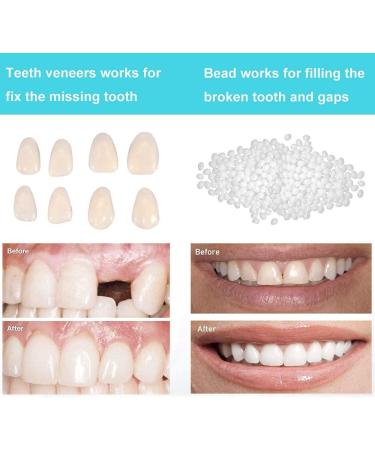 OTCPP Temporary Tooth Repair Kit - Teeth Veneers for Missing Tooth Support - Buy Online on SooperMarket.com