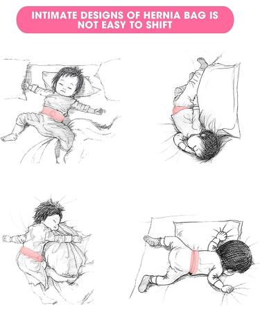 Hernia Belt for Babies - 2pcs Infant Umbilical Hernia Therapy Treatment Set | Baby Belly Button Band for Abdominal Support - Pink - Buy Online on SooperMarket.com