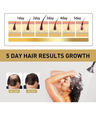 Sakura Japanese Shampoo Sakura Shampoo and Conditioner Japanese Sakura Shampoo Japanese for Hair Loss Moisturizing Repair Hair Growth Shampoo for Dry Damaged Hair (Shampoo) - Buy Online on SooperMarket.com