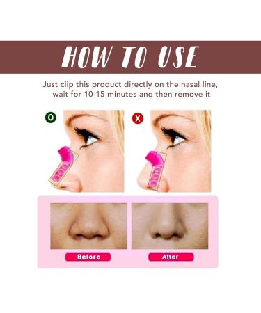 Zetiling Nose Shaper - Adjustable Silicone Nose Lifter & Straightener for Perfect Nose Shape | 2pcs Nose Up Clip - Buy Online on SooperMarket.com