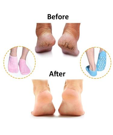 Moisturizing Gel Socks - 2 Pairs of Reusable Soft Socks with Essential Oil Treatment for Dry Skin Pink & Blue - Buy Online on SooperMarket.com