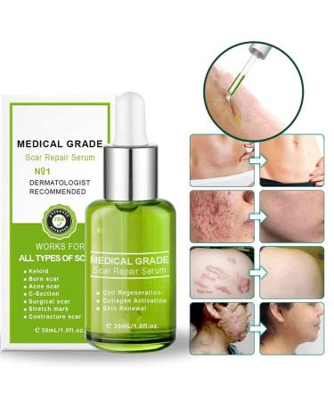 Goopgen Advanced Scar Repair Serum 30ML - Nature Scar Treatment - Scar Removal Serum for All Types of Scars (1PC) - Buy Online on SooperMarket.com