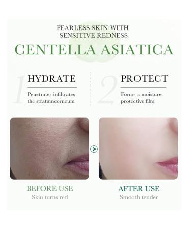 Centella Asiatica Soothing Repair Facial Serum | Lightweight Hydrating Daily Moisturizer | Anti-Acne & Oil Control | 30ml - International Shipping - Buy Online on SooperMarket.com