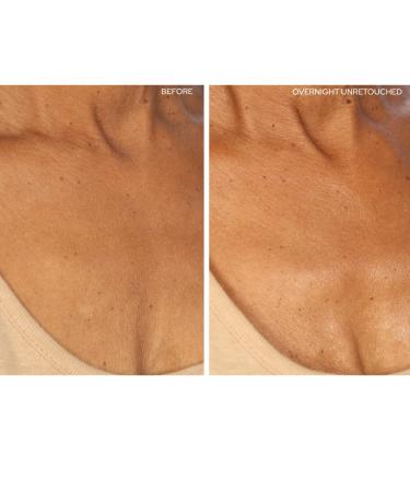 SiO Beauty SkinPad Silicone Chest Anti-Wrinkle Patches - 2 Weeks Supply - Buy Online on SooperMarket.com
