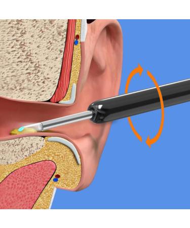BTSEURY Rechargeable Wireless Visual Ear Cleaner - Ear Wax Remover Tool for Earwax Cleaning in Black - Buy Online on SooperMarket.com