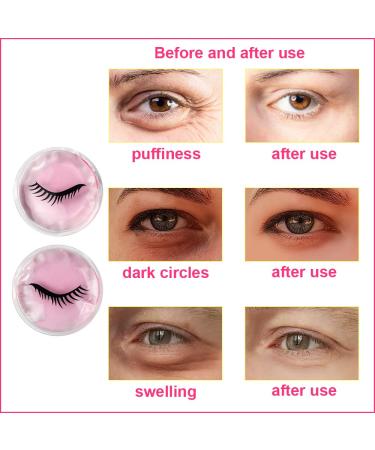 CONBELLA Pink Cooling Face Mask for Dark Circles, Puffiness, Migraines, Headache, Stress, Redness, Acne - Hot/Cold Therapy for Women and Men - Buy Online on SooperMarket.com