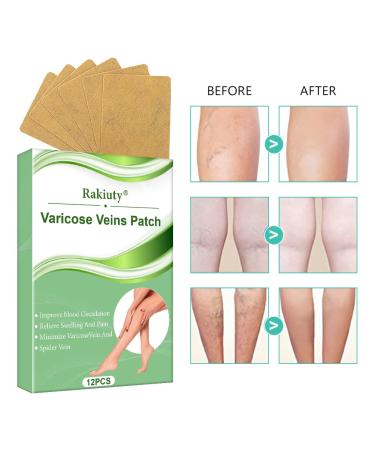 Varicose Veins Patch - Effective Treatment for Spider Veins | 12 Pcs | Fast International Shipping - Buy Online on SooperMarket.com