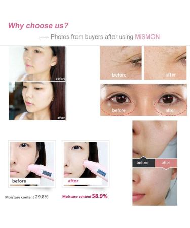 MiSMON 5 in 1 Facial Massager with High Frequency Wand and LED Light Therapy for Skin Tightening, Wrinkle and Acne Removal - Buy Online on SooperMarket.com
