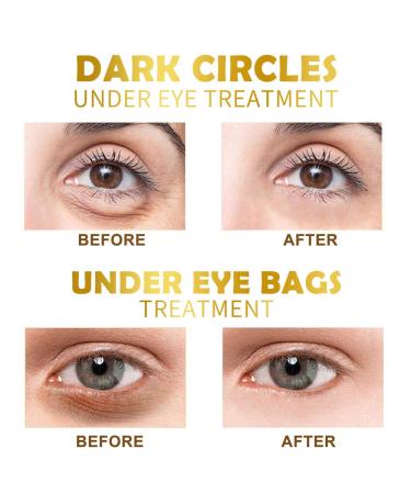 30 Pairs Gold Under Eye Patches with Collagen Treatment for Dark Circles and Wrinkles - Anti-Aging Eye Gel Pads for Women and Men - Buy Online on SooperMarket.com