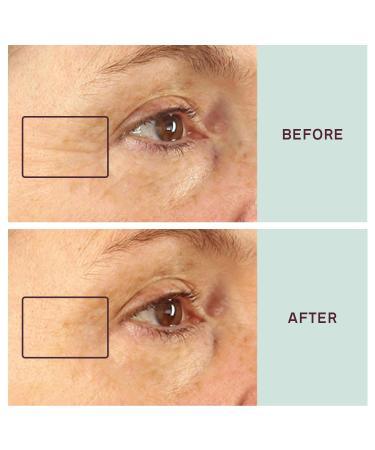 Dermaclara Siliconefusion Eyes and Mouth Patches - Reusable Hypoallergenic Silicone for Fine Lines, Wrinkles, Scars - 4 ct - Buy Online on SooperMarket.com