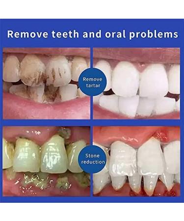 SP-6 Ultra Whitening Toothpaste - Probiotic Brightening Deep Cleaning Prevents Tartar Fresh Breath | International Shipping - Buy Online on SooperMarket.com