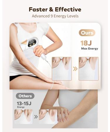 ZKMAGIC IPL Hair Removal Device - 3-in-1 with 9 Energy Levels | Pain-Free Laser Hair Removal for Men & Women | 999 900 Light Impulses | Buy Online Now! - Buy Online on SooperMarket.com