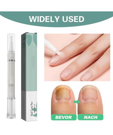 4-Piece Nail Care Pen Set with Tea Tree Oil Vitamin E & Aloe Vera - Well-Groomed Fingernails & Toenails - Includes Nail File - Green - Buy Online on SooperMarket.com
