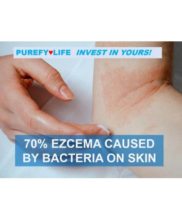 PUREFY Dermal Eczema Airesol Spray 3.4oz 2pk - Natural Healing with Purefypro Cleansing Technology | Safe for Kids | Dermatologist Recommended - Buy Online on SooperMarket.com