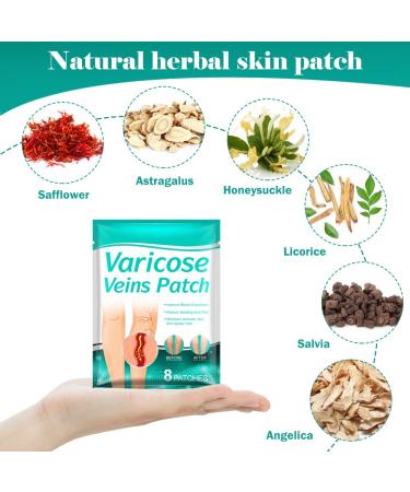 Fengyang 16Pcs Varicose Veins Treatment Patch Set for Legs - Spider Vein Relief, Soothes Leg Fatigue - Buy Online on SooperMarket.com