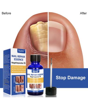 Premium Nail Care & Treatment | Repair Broken & Discolored Nails with Nourishing Nail Oil & Serum for Healthy Hands & Feet - Buy Online on SooperMarket.com