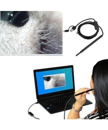 Earwax Removal Kit with Camera | Home Ear Cleaning Tool - Buy Online on SooperMarket.com