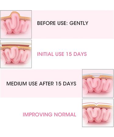 Hernia Belt for Babies - 2pcs Infant Umbilical Hernia Therapy Treatment Set | Baby Belly Button Band for Abdominal Support - Pink - Buy Online on SooperMarket.com