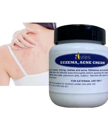 Alvies Abd Herbal Antibacterial Cream Anti-itch Relief