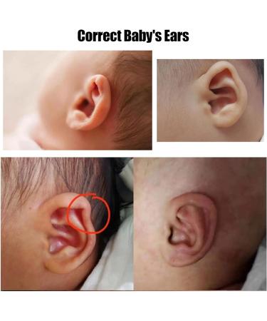 Baby Ear Corrector Silicone Kids Infant Ear Tape Scar Tape Protruding Ear Patch Stickers Newborn Baby Ear Aesthetic Correctors (4cm*100cm (1 roll/Box)) - Buy Online on SooperMarket.com