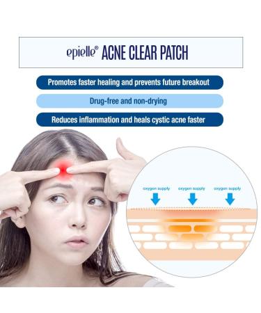 Epielle Acne Clear Patch - Hydrocolloid Pimple Patch for Face & Skin, 4 Pack Acne Spot Treatment Stickers - Cruelty-Free, Two Patch Sizes 8mm & 10mm - Buy Online on SooperMarket.com
