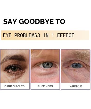 Eye Cream for Dark Circles and Puffy Eyes - Snail Peptide Energetic Eye Roll-On - Eye Bags Remover Eye Cream Anti aging - Under Eye Roller cream - Reduce Lines Wrinkles Puffiness and Dark Circles (1) - Buy Online on SooperMarket.com