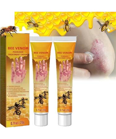 Doxenem Youth Bee Venom Psoriasis Treatment Cream Soothing and Moisturizing Psoriasis Cream New Zealand Bee Venom Professional Psoriasis Treatment Cream for All Skin Types